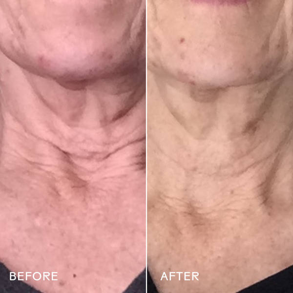 Crème lissante pour le cou & visage- Firm Believer - Cellules souches de goji & grenade – Image 3